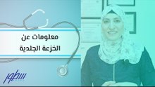 معلومات عن الخزعة الجلدية