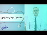 ما علاج تكيس المبايض