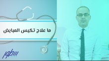 ما علاج تكيس المبايض