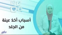 أسباب أخذ عينة من الجلد