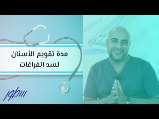 مدة تقويم الأسنان لسد الفراغات