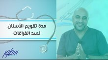 مدة تقويم الأسنان لسد الفراغات