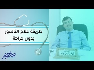 طريقة علاج الناسور بدون جراحة
