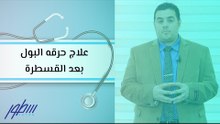 علاج حرقه البول بعد القسطرة
