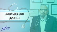 علاج مرض اليرقان عند الكبار