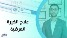 علاج الغيرة المرضية