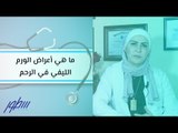 ما هي أعراض الورم الليفي في الرحم