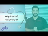 أسباب انحراف صابونة الركبة