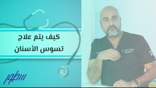 كيف يتم علاج تسوس الأسنان