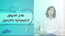 علاج الحروق الكيميائية بالتجميل