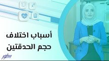 أسباب اختلاف حجم الحدقتين