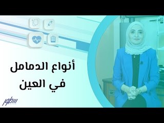 أنواع الدمامل في العين