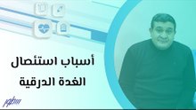 أسباب استئصال الغدة الدرقية