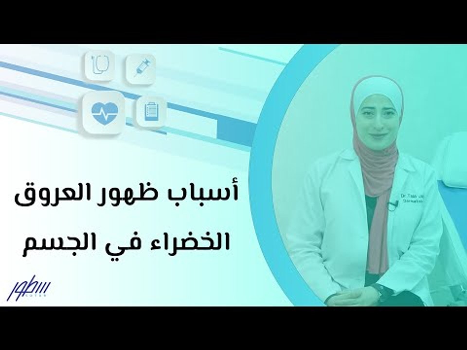 أسباب ظهور العروق الخضراء في الجسم
