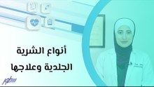 أنواع الشرية الجلدية وعلاجها