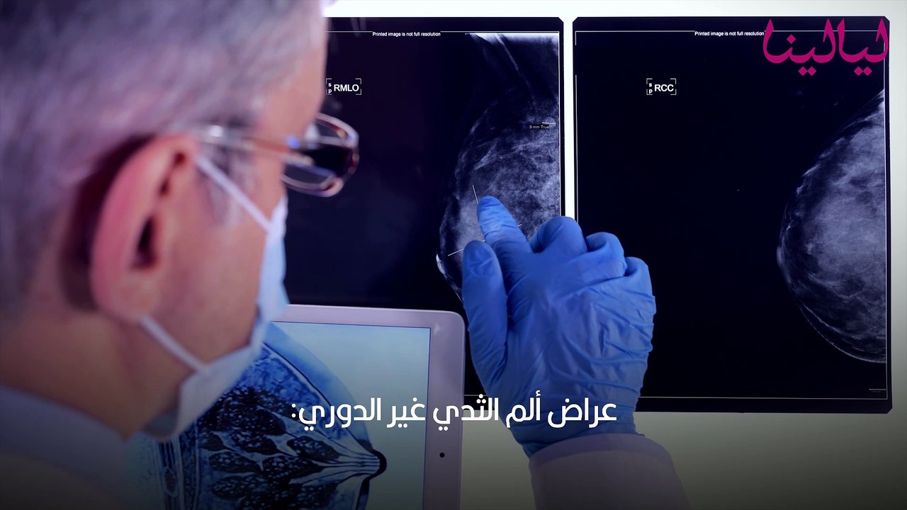 الام الثدي