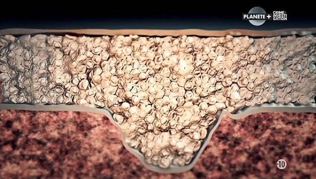 Hollywood autopsy S1E01 Michael Jackson