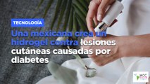 Una mexicana crea un hidrogel contra lesiones cutáneas causadas por diabetes