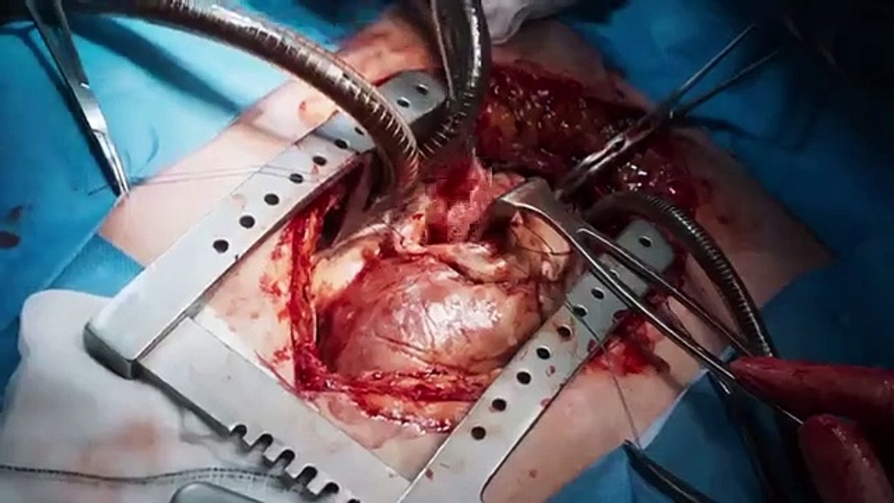 Holby City - Se22 - Ep18 HD Watch