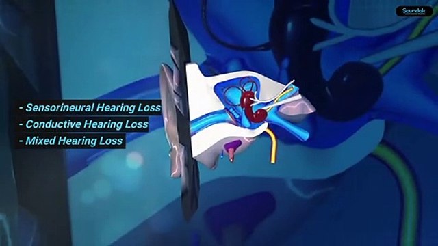 Warning Signs That Tell You Are Suffering From Hearing Loss