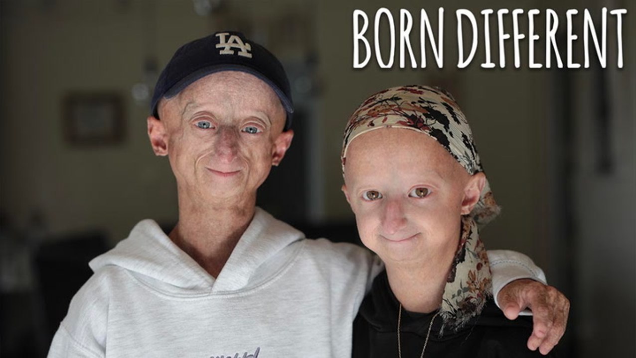The People Who Age Too Fast | BORN DIFFERENT - video Dailymotion