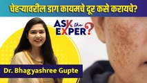 How To Remove Dark Spots | चेहऱ्यावरील डाग कमी कसे करायचे | Dark Spots | Lokmat Sakhi | AS