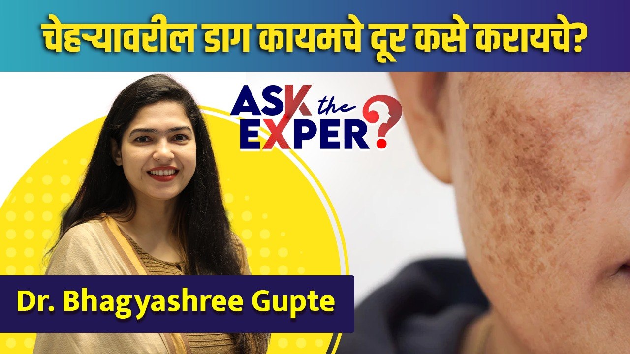How To Remove Dark Spots | चेहऱ्यावरील डाग कमी...