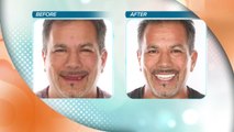 Cosmetic & Implant Dentistry Center's Dr. Valenzuela says he can improve your smile with dental implants