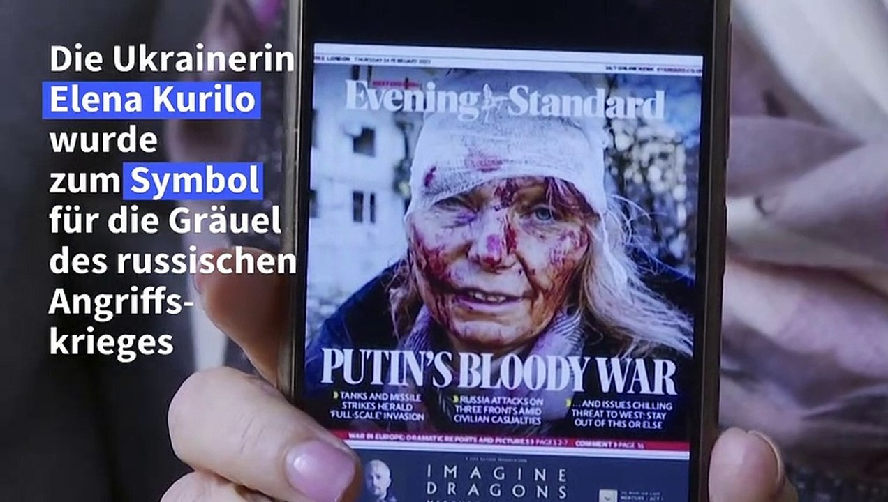 Gesicht des Ukraine-Krieges: 'Ich erinnere mich an jede Glasscherbe'