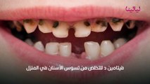 تسوس الاسنان في البيت علاج