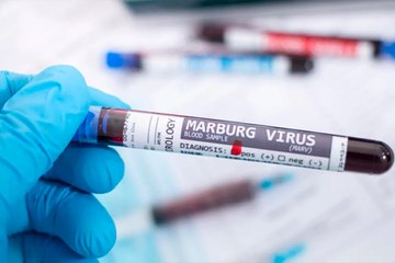 فيروس "ماربورغ" يظهر مجددا ويثير قلق منظمة الصحة