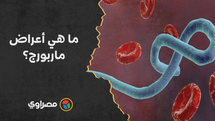 فيروس فتاك يضرب العالم.. ما هي أعراض ماربورج؟