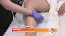Legs crawling with spider or varicose veins? Discover the Vein Envy difference TODAY