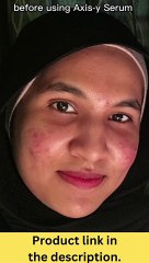 axis y dark spot corrector serum. Link in description.