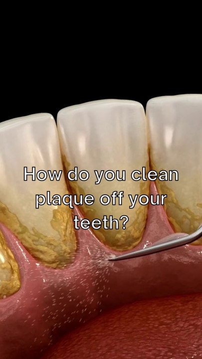 How do you clean plaque off your teeth?