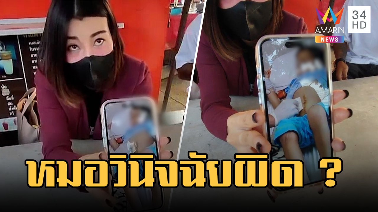 แม่ช็อก! หมอจับลูกผ่าท้องไส้ติ่งแตก-ลำไส้อุดตัน สุดท้ายวินิจฉัยผิด | ข่าวเที่ยงอมรินทร์ | 17 ก.พ.66