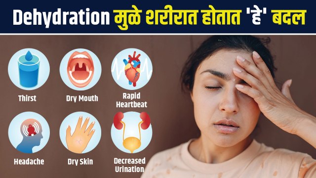 Dehydration मुळे नेमकं काय होतं? | How to Get Rid of Dehydration | Dehydration Symptoms | AS