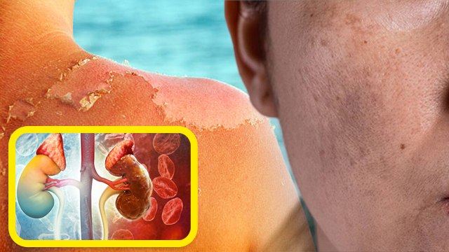 स्किन सेंसिटिव क्यों होती है | Skin Sensitive Kyu Hoti hai | Sensitive Skin Kya Hoti Hai |Boldsky