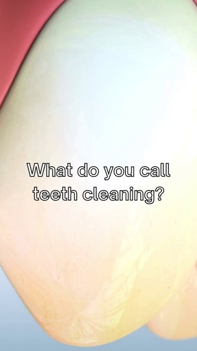 What do you call teeth cleaning?