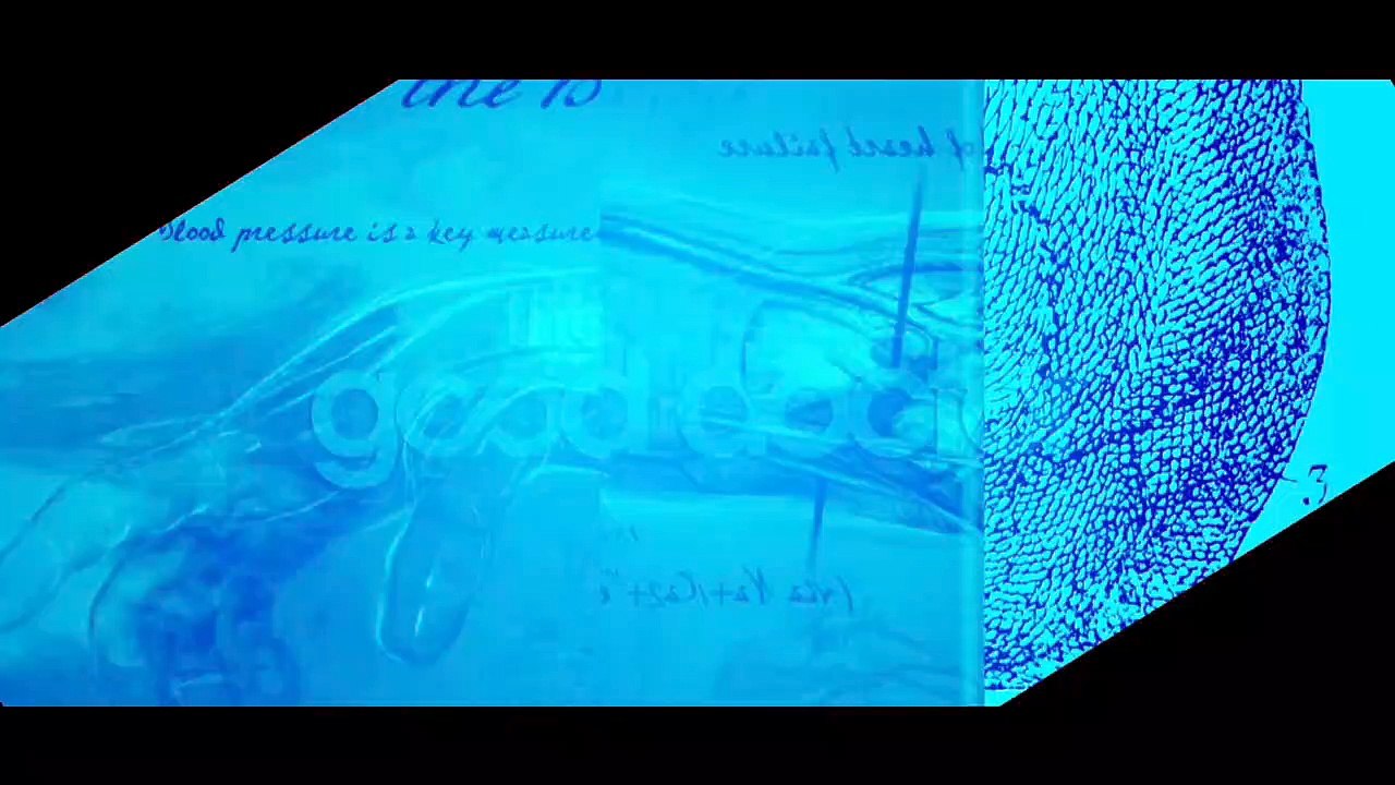 The Good Doctor Season 6   EPISODE 13 PROMO TRAILER   the good doctor season 6 episode 13 trailer