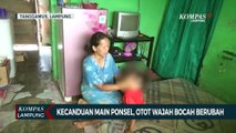 Otot Wajah Bocah Berubah Akibat Kecanduan Main Ponsel!
