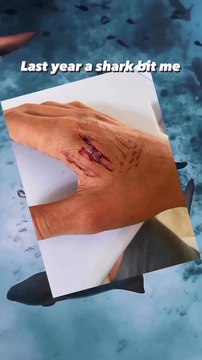 Il va nager au milieu des requins et se fait mordre la main