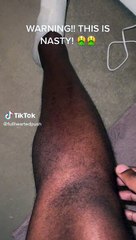 Deportista genera polémica tras mostrar sus "piernas de plastilina"