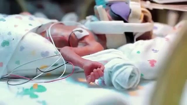 First Year Of A Baby Born 3.5 Months Premature!!