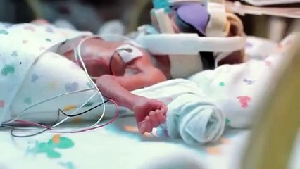 First Year Of A Baby Born 3.5 Months Premature!!