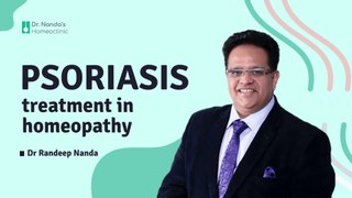 Psoriasis Treatment in Homeopathy (Hindi) सोरायसिस| Dr Nanda #psoriasis #psoriasistreatment