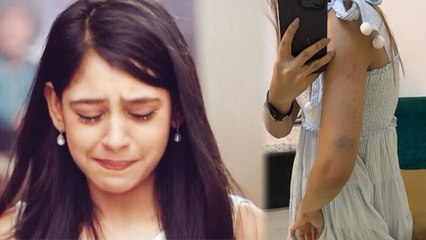 Niti Taylor Injured, TV Show Bade Achhe Lagte hai 2 Set पर कैसे हुआ Accident | Boldsky