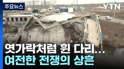 엿가락처럼 휜 다리...여전한 전쟁의 상흔 / YTN