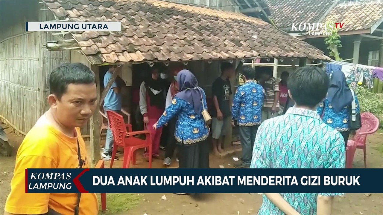 2 Anak Lumpuh akibat Menderita Gizi Buruk