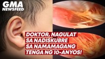 Doktor, nagulat sa nadiskubre sa namamagang tenga ng 10-anyos! | GMA News Feed